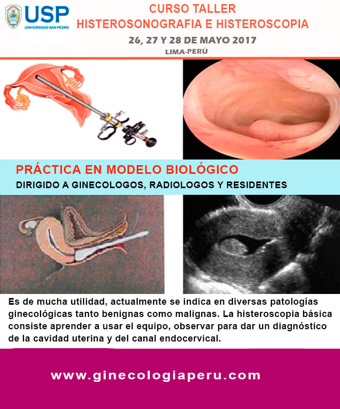 Curso Taller de Histerosonografia e Histeroscopia, 26, 27 y 28 de Mayo ...